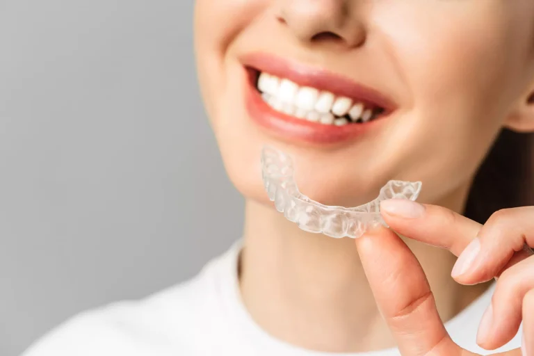 How Invisalign Aligners Adapt to Your Unique Tooth Movement Patterns