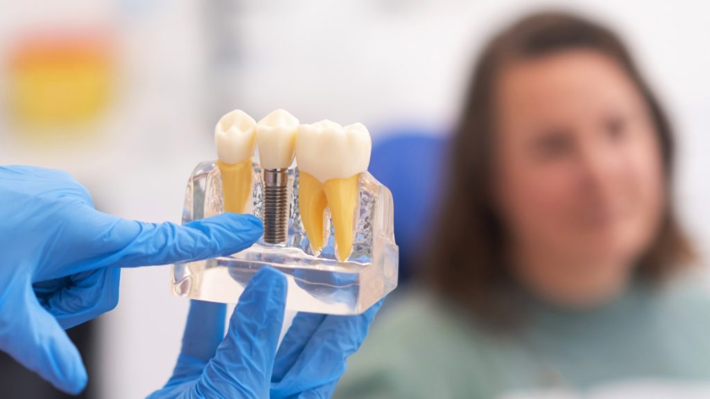 How Dental Implants Influence Vitamin Absorption and Nutritional Wellbeing Through Improved Mastication